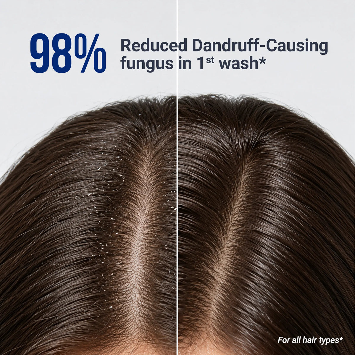 Dandruff Control Shampoo – 200ml